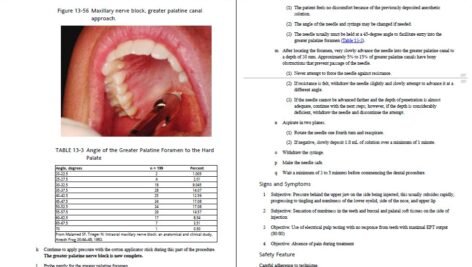 دانلود فایل کتاب بی حسی موضعی در دندانپزشکی انتشارات رویان پژوه PDF